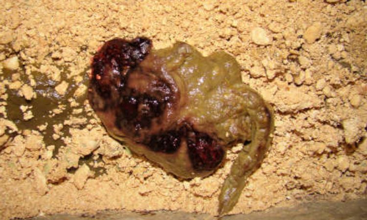 Common Causes of Bloody or Mucus-Filled Stool