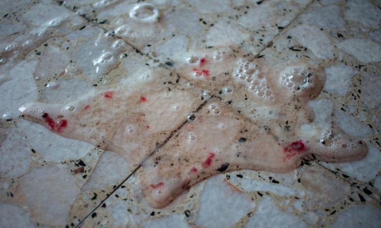 Red or Pink Vomit (Blood)
