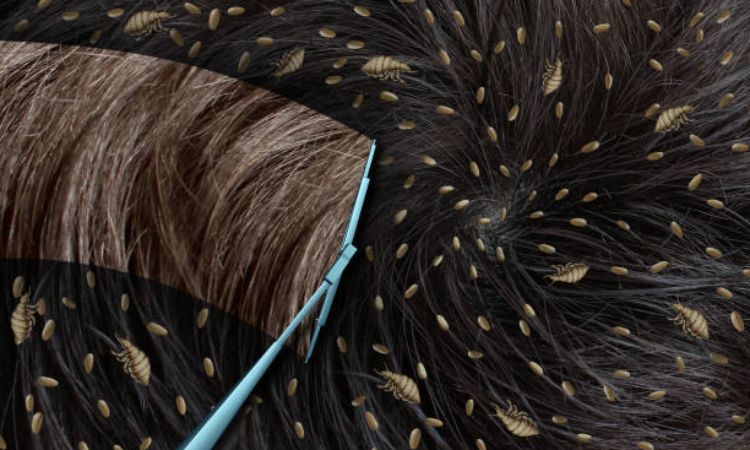 Cat Lice Treatment and Prevention